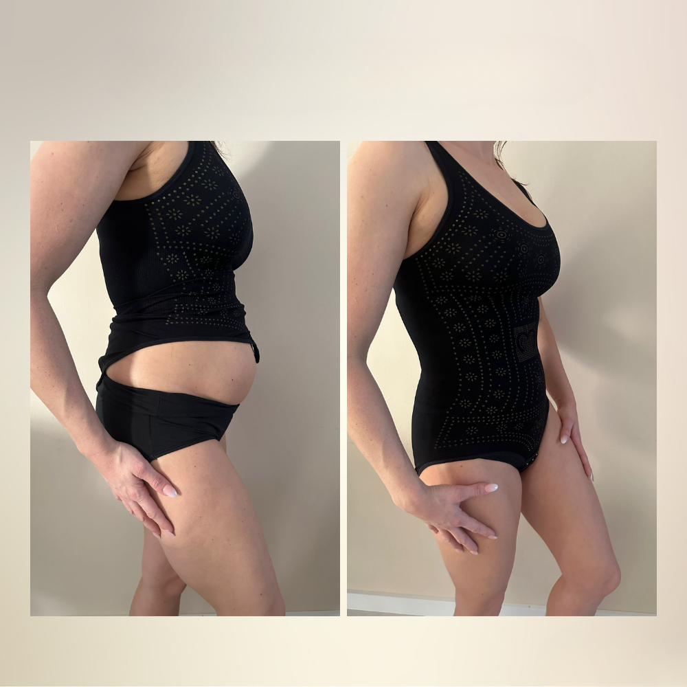 Ella – Vormende shapewear body met ContourFlex